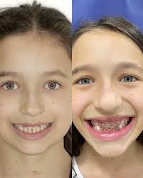 Fabrício Ritter (@drfabricioritter) • Instagram photos and videos