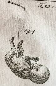Eur j obstet gynecol reprod biol. Artist Of Death Frederik Ruysch At Nyam Guest Post By Morbid Anatomy S Joanna Ebenstein Books Health And History