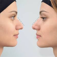 Armonización Orofacial