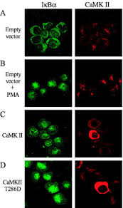 There are three pmas located on the international space station (iss). Calmodulin Dependent Kinase Ii Mediates T Cell Receptor Cd3 And Phorbol Ester Induced Activation Of Ikb Kinase Journal Of Biological Chemistry