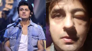 He said that even prime minister narendra modi is respectful of citizens, unlike yadav. Sonu Nigam Suffers Allergy After Eating Seafood