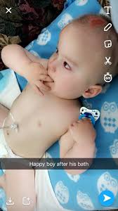 Casen Bremer's Journey with Linear Nevus Sebaceous Syndrome