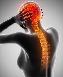 Image result for Spinal Headache