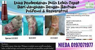 Sekiranya anda juga mencari ubat kencing manis, silalah kunjungi website saya ini. Luka Kencing Manis Sembuh Dengan Pantas Ohcantik Com