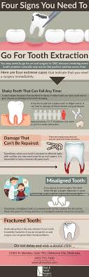 Four Signs You Need To Go For Tooth Extraction Urstoryz Tooth Extraction Dental Extraction Teeth Health