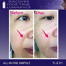 Jual Krim Penghilang Stretch Mark Di Apotik Trulum Anti Selulit Jakarta Timur Trulum Skincare Instant Tokopedia
