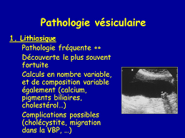 À propos d'un cas | find, read and cite all the research you need on researchgate Imagerie Des Voies Biliaires Ppt Video Online Telecharger