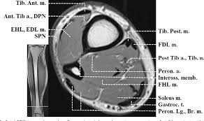 Want to learn more about it? Figure 12 From Normal Mr Imaging Anatomy Of The Thigh And Leg Semantic Scholar