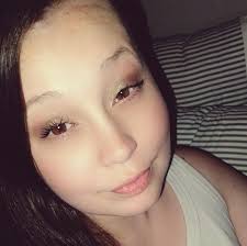 Meet Charlotte and Dr. Scott Bartlett, one of our plastic surgeons!  Charlotte is treated for sagittal craniosynostosis. Her condition required  surgery to allow room for her brain to grow. She underwent surgery