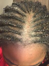 Explore other popular beauty & spas near men and women decide to braid their hair for various reasons. My Stylist Braided My Hair Too Tight And Now It Looks Like This What Is Happening What Can I Do Blackhair