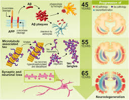 On apoe ε4 status which represented the genetic dementia risk. Inflammation The Link Between Comorbidities Genetics And Alzheimer S Disease Journal Of Neuroinflammation Full Text