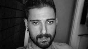 Ido Tatlises In Estetik Sonrasi Ilk Hali Magazin Gune Dogus Haber