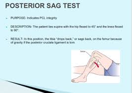 Image result for PCL Sulcus Test