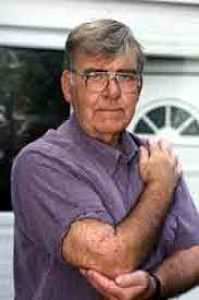 Mayor's warning after penicillin reaction