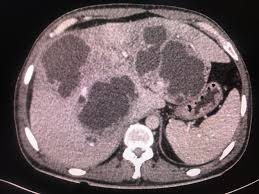 Pin By Pankaj Kaira On Radiology Interesting Cases And Spotters Diagnostic Imaging Radiology Case