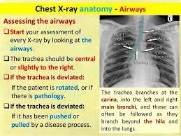 Pin By Miissmiicc On Med Radiology Imaging X Ray Medical Knowledge