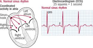 Atrial Fibrillation Common Serious Treatable Harvard Health