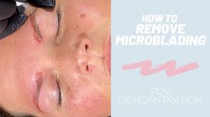 Can microblading eyebrows be removed? How To Saline Tattoo Microblading Removal Youtube