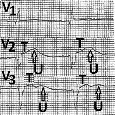 Image result for U Wave