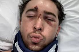 I was paralysed from neck down but recovered to kick friend in crotch'