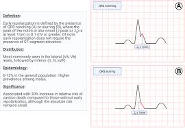 Image result for Early Repolarization