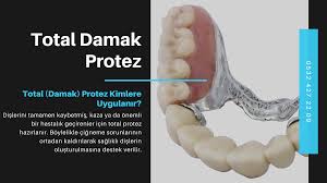 Total Damak Protez Gulus Estetigi