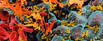 Can you drink with a uti. Treating A Uti Debunking Some Myths Cutic