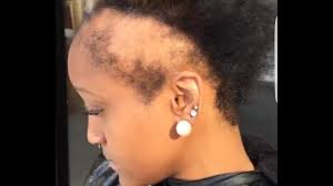 This style makes a bold statement and if you have thinning in your temples you can easily camouflage it with a chic short cut. No Edges To The Perfect Edges Youtube