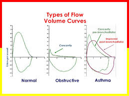 spirometry basics 2