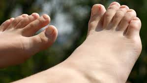 Sabemos que sufrimos este problema. Para Correr No Olvides Cortar Bien Las Unas