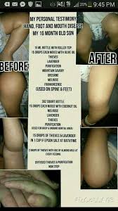 Pin On Hfmd Young Living