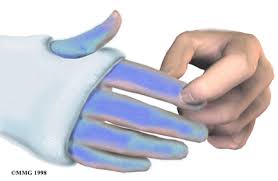 Check spelling or type a new query. Cast Care Eorthopod Com