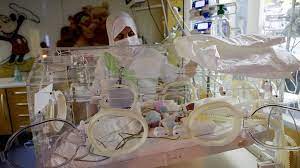 Learn how to perform a lung/thoracic/pulmonary ultrasound protocol and recognize all common lung ultrasound pathology! 3eqhrv 7eqh7um