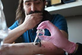 More images for how to get rid of leeches » Leech Therapy What Does It Feel Like And Does It Work