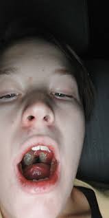 When was Alleghany Memorial Hospital built and what was the building