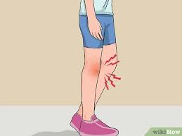 We did not find results for: 4 Cara Untuk Merawat Lutut Yang Bengkak Wikihow