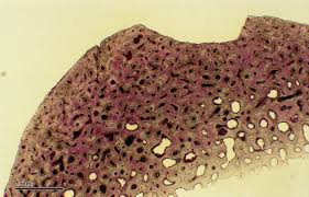 It consists of two layers; File Bone 247 29a Human Bone Cross Section Jpg Wikimedia Commons