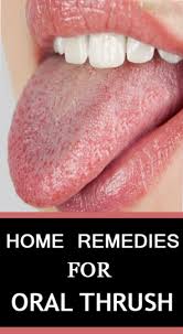 Home Remedies For Oral Thrush Oral Thrush Remedies Home Remedies For Thrush Yeast Infection Causes