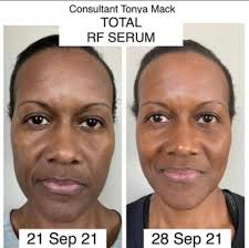 Sherri Williamson Rodan+Fields Consultant