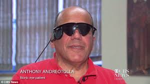 Boston man's bionic eye gives back sight to blind man