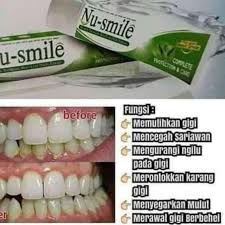 Jual Hwi Nusmile Pasta Gigi 100 G Online Desember 2020 Blibli