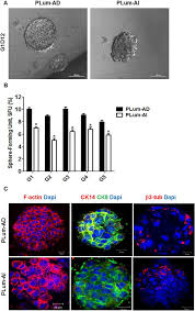 PLum‑AD and PLum‑AI cell lines display stem‑like cell properties. (A)... |  Download Scientific Diagram