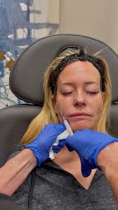 Sculpted by Sculptra ✨, Watch as we enhance natural beauty using Sculptra —  a biostimulatory injectable that works with your body to restore collagen  and improve skin texture! 💉, We love Sculptra ...