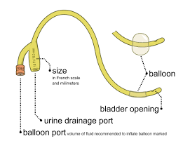 foley catheter wikipedia