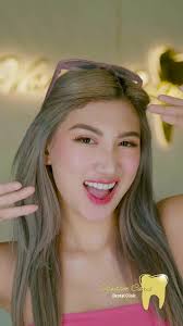 Transform Your Smile with E-max Veneers Today