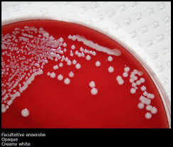 Image result for Staphylococcus Saprophyticus