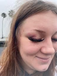 our 7 month old pup gave my girlfriend a black eye, oops 😅