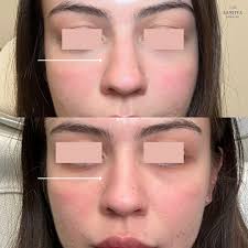 Love learning from the BEST! Thank you Allergan, you did it again! Chic  restaurant, awesome food and drinks, and of course, the wisdom of Dr. Deb  Sherman. It all is making sense!