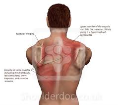 Image result for Winged Scapula