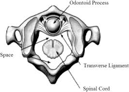 Check spelling or type a new query. Fractures Of The C1 And C2 Vertebrae Sciencedirect